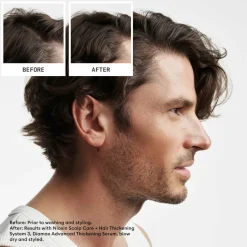 Nioxin System 2 Loyalty Kit